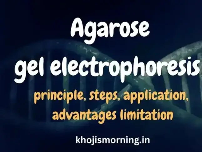 Agarose gel electrophoresis prinicple and application